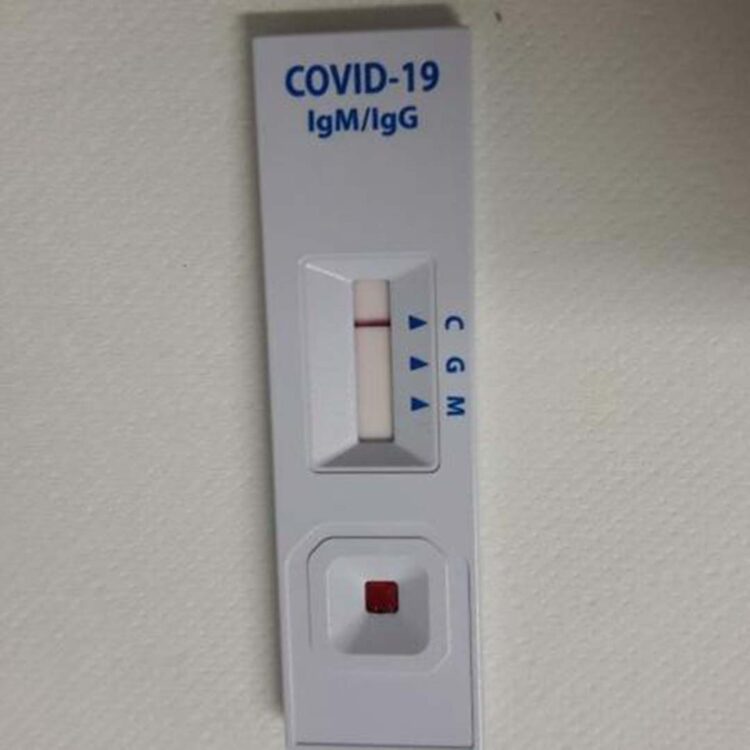 Testes de Covid positivos em farmácia alcançam menor patamar na pandemia