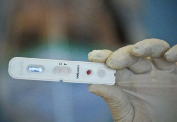 Maioria dos infectados por Covid-19 apresenta sintomas após seis meses