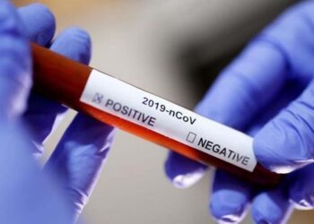 Brasil registra 66 mortes por Covid em 24 h e mais de 2,8 mil casos