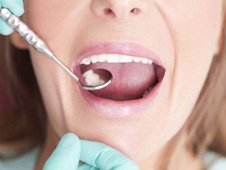 99% da população brasileira já  teve um dente permanente cariado