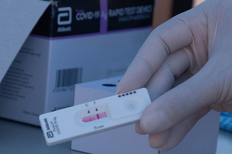 Paranavaí tem 840 pessoas em período de transmissão do coronavírus