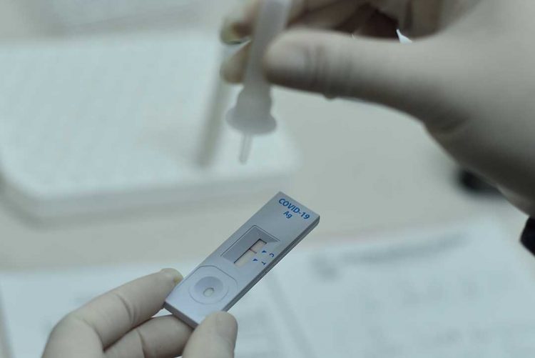 Paranavaí registra 15 casos de Covid-19 em 24 horas, menor número desde dezembro do ano passado