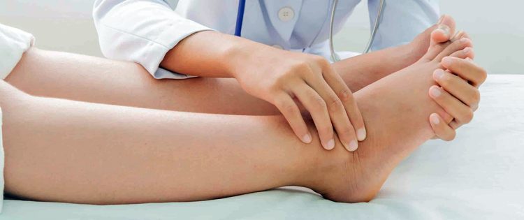 Inchaço em braços ou pernas pode ser linfedema; conheça a doença