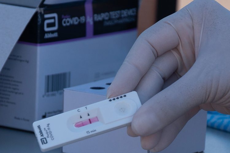 Paranavaí tem 15 novos casos de Covid-19 em 24 horas