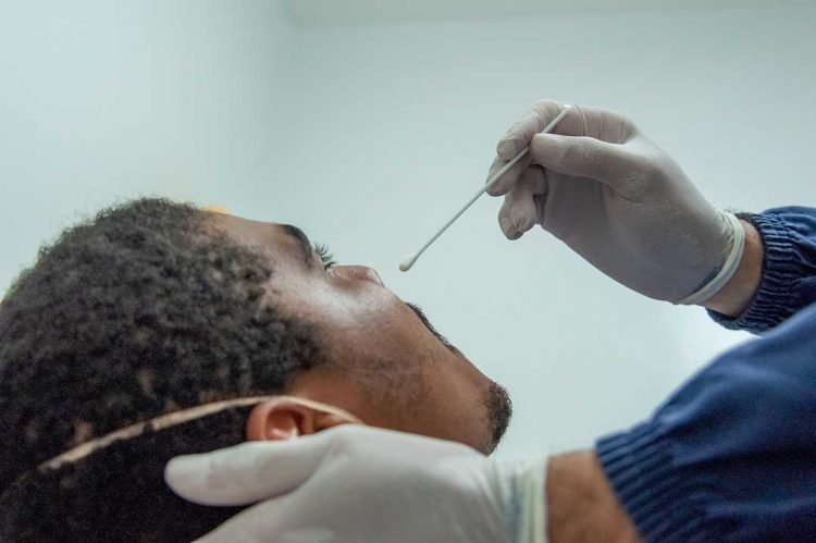 Boletim Covid aponta 35 novos casos em Paranavaí