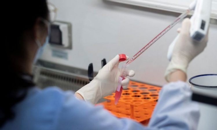 Brasil registra 148 mortes por Covid e mais de 31 mil casos em 24 horas