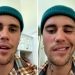 Justin Bieber explica síndrome que paralisou seu rosto: “Muito perigoso”