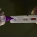 Pesquisadores identificam método capaz de prever gravidade da covid-19