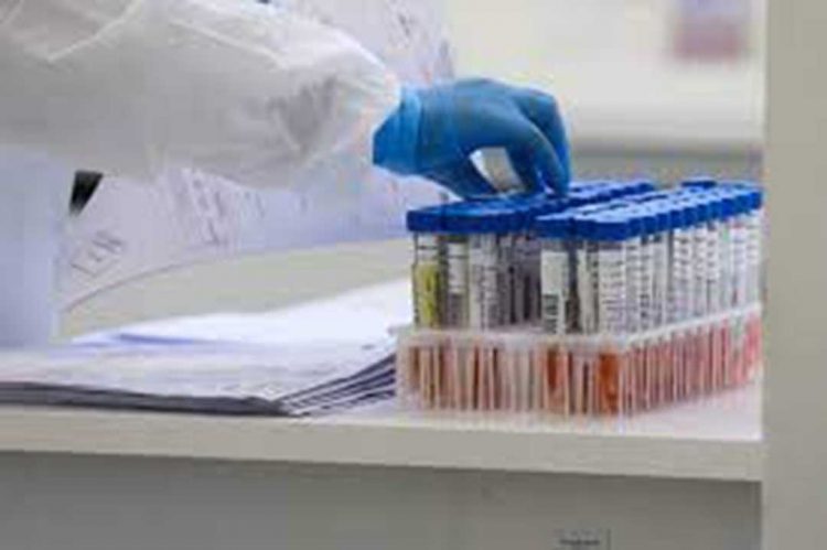 Pesquisa lista 62 sintomas da Covid longa