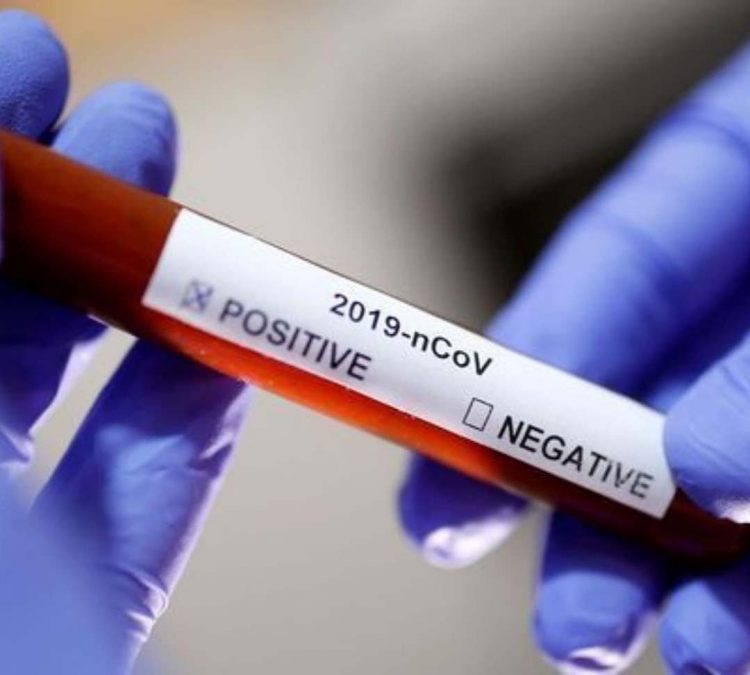 Brasil registra 70 mortes por Covid e mais de 7 mil casos