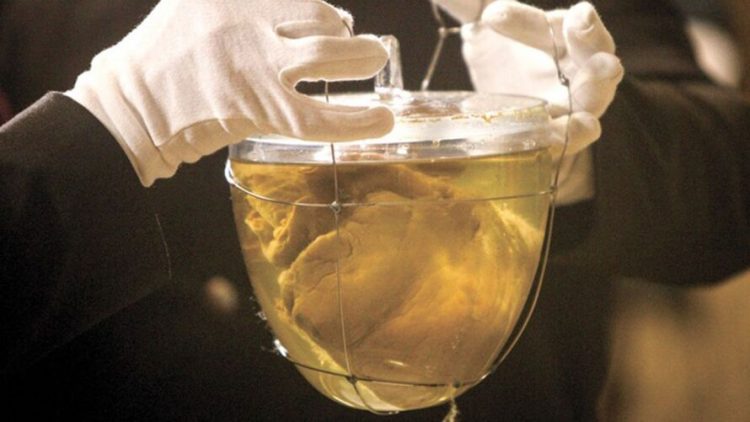 Aspecto ‘inchado’ do coração de dom Pedro 1º intriga cientistas