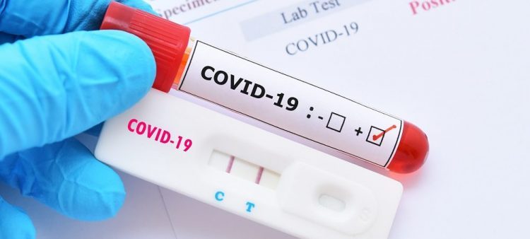 Brasil registra 254 mortes por Covid e mais de 29 mil casos