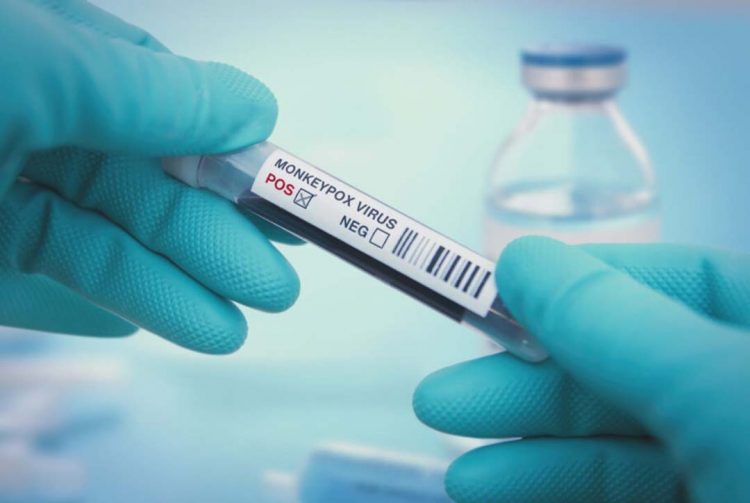 Ministro diz que Brasil terá antiviral para tratar varíola dos macacos