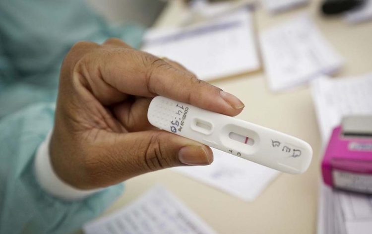 Testes de Covid em farmácias chegam ao menor patamar da pandemia