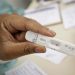Testes de Covid em farmácias chegam ao menor patamar da pandemia