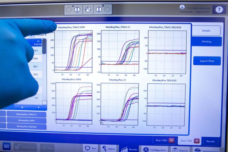 Paraná registra mais 11 casos de Monkeypox