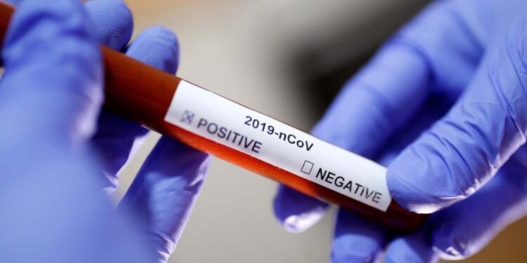 Outubro registrou o menor número de casos positivos de Covid dos últimos 30 meses