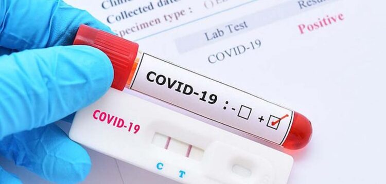 Farmácias preveem nova escalada em testes positivos de Covid