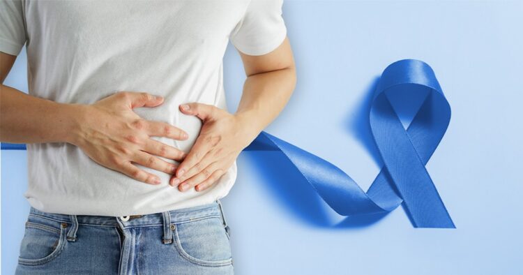 Fatores genéticos são a causa de  20% dos casos de câncer colorretal