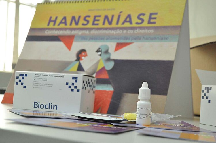 Testes rápidos fazem parte da estratégia  para diagnóstico precoce da hanseníase