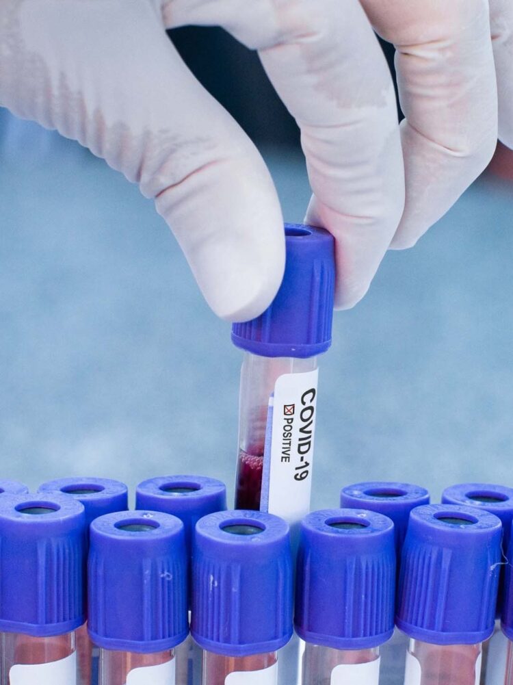 OMS declara fim da emergência em saúde por covid-19