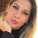 Maíra Cardi dá detalhes de problema grave na coluna