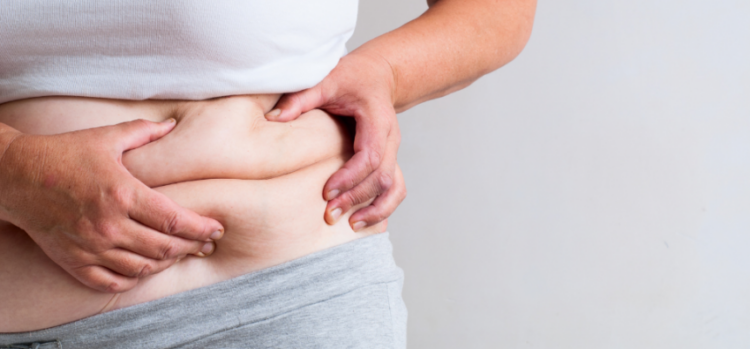 Estão abertas as inscrições para o programa de tratamento de obesidade em Paranavaí