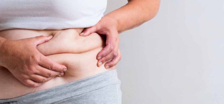 Abertas inscrições para o tratamento da obesidade