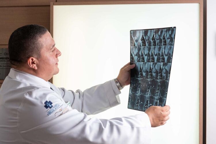 Entenda a condição que afeta a coluna