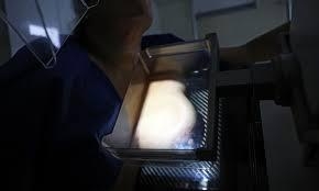 Câmara aprova projeto para garantir mamografia anual no SUS a partir dos 40 anos