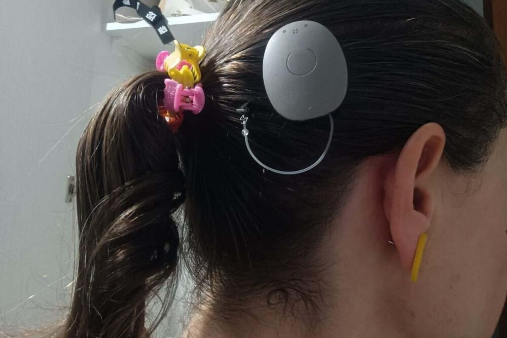 Implantes beneficiam a comunidade paranaense