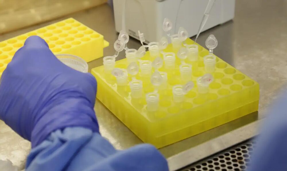 Paraná intensifica testagem para HIV e fortalece linha de cuidado materno-infantil
Foto: Gilson Abreu/Arquivo AEN