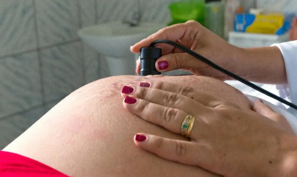 s-gesta Houve redução na ocorrência de partos prematuros e queda de 16% na mortalidade de crianças menores de cinco anos
Foto: Arquivo/MDS