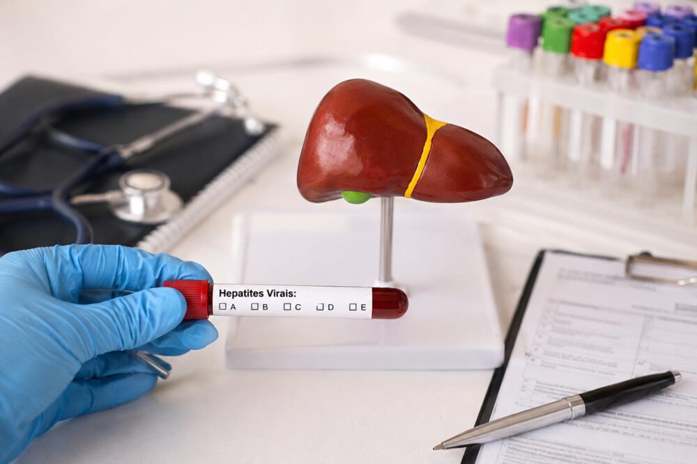Em muitos casos, hepatites não apresentam sintomas e demandam que o paciente realize sempre exames de rotina para checagem. (Foto ilustrativa gerada por IA)