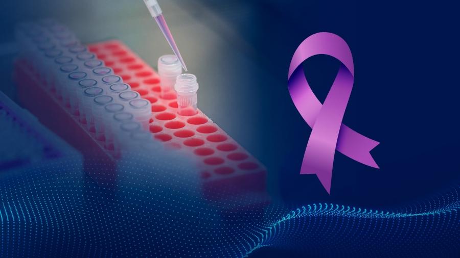 É importante prevenir a doença, alerta SUS
FOTO: sboc.org